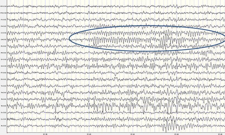 Mu rhythm EEG display